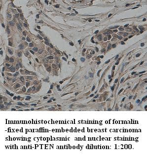 Polyclonal Rabbit anti-Human PTEN Antibody (C-Terminus, IHC)