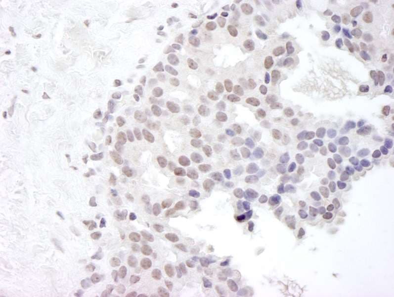GEMIN4 Antibody (aa1010-C-term)