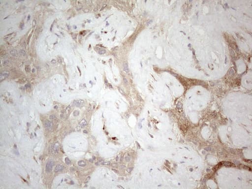 LOXL2 Antibody (aa152-450, clone OTI8G5)