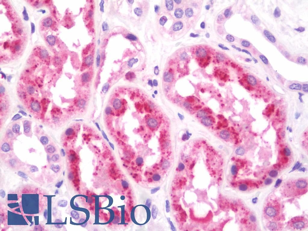 IHC-plus™ Polyclonal Rabbit anti-Human HOPX / HOP Antibody (aa39-67, IHC, WB)