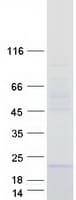 Human MGC34774 Protein (Recombinant Myc-DDK (Flag))
