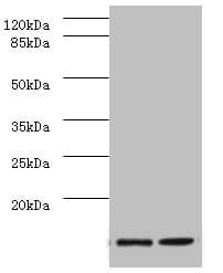 SAA1 / SAA / Serum Amyloid A Antibody
