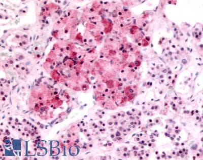 PathPlus™ Polyclonal Rabbit anti-Human MTNR1B / MT2 Antibody (Extracellular Domain, IHC)