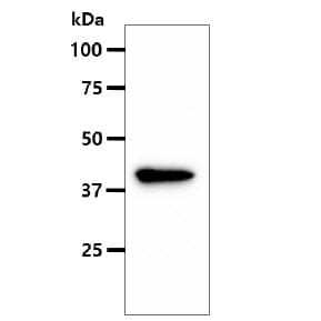 Monoclonal Mouse anti-Human ASS1 / ASS Antibody (clone AT1G11, WB)