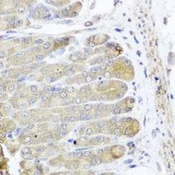 IRS2 / IRS-2 Antibody