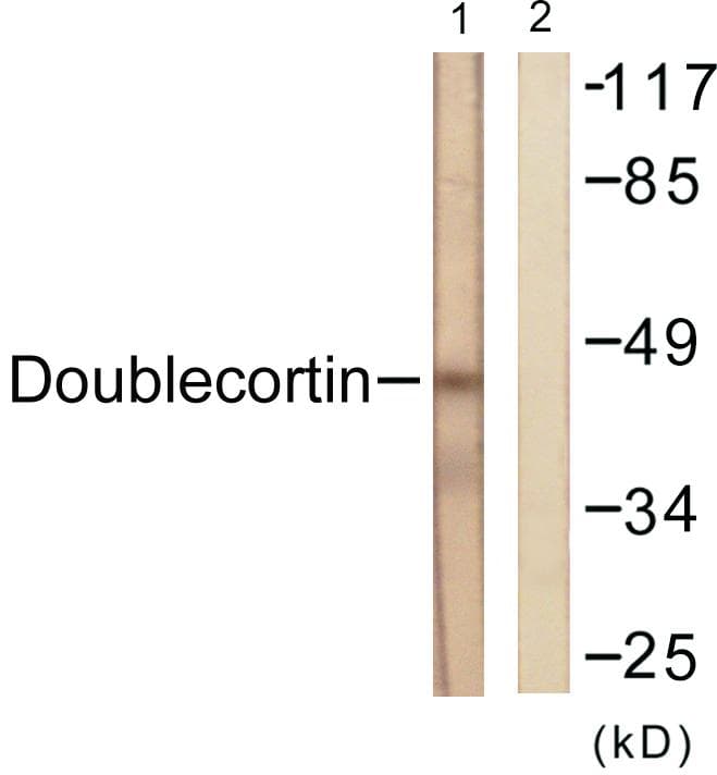 Polyclonal Rabbit anti-Human DCX / Doublecortin Antibody (p297, WB)