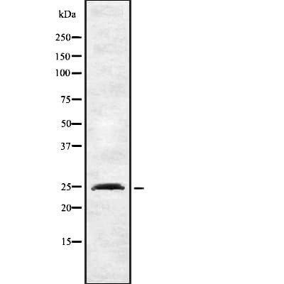 Polyclonal Rabbit anti-Human INSIG2 Antibody (WB)