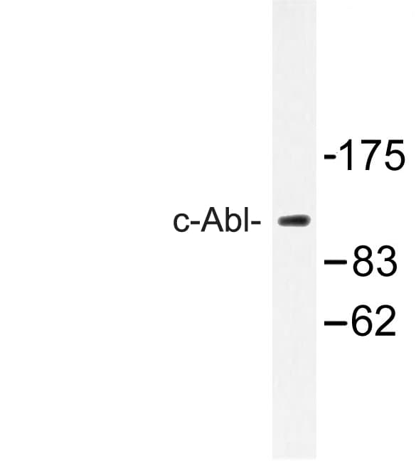 ABL1 / c-ABL Antibody (Glu883)
