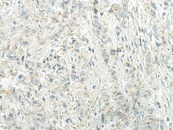 Polyclonal Rabbit anti-Human UQCC2 / MNF1 Antibody (IHC)