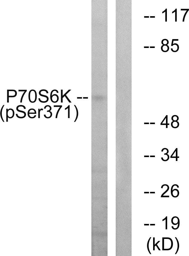 RPS6KB1 / P70S6K / S6K Antibody (phospho-Ser371)