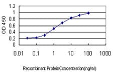 Monoclonal Mouse anti-Human MYNN Antibody (clone 3E8, IHC, IF, WB)