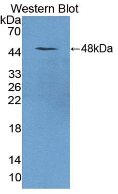 TRDN / Triadin Antibody