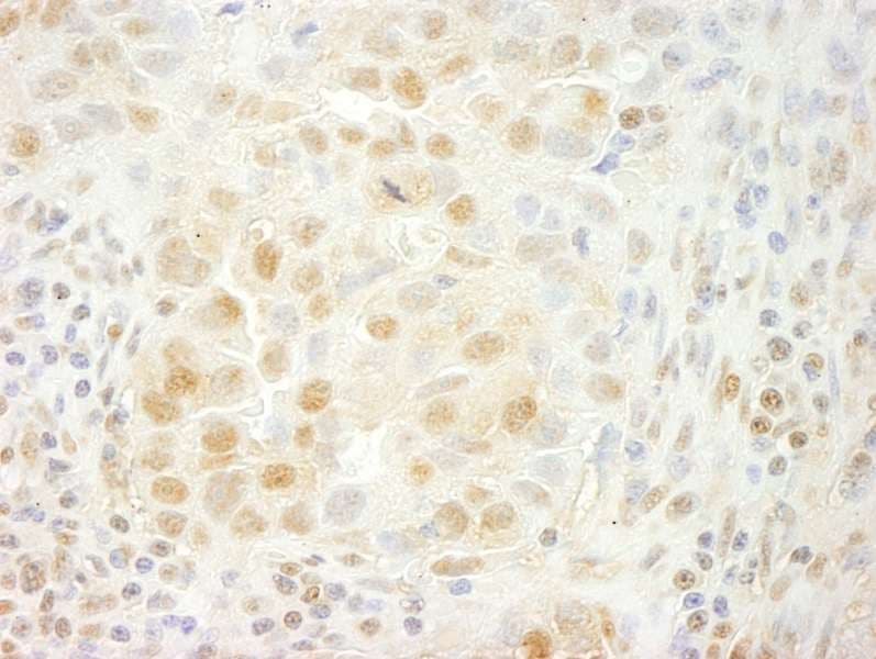 PRPF4B Antibody (aa1-50)