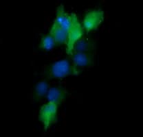 MAP2K1 / MKK1 / MEK1 Antibody (clone OTI1A10)