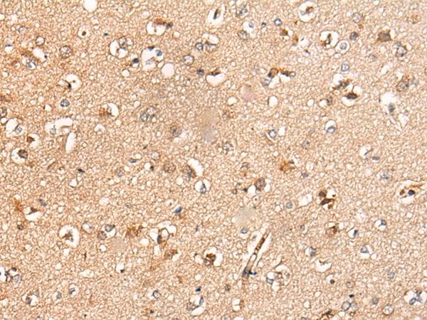 KLHL36 Antibody