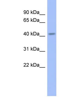Polyclonal Rabbit anti-Human GBX2 Antibody (aa179-228, WB)
