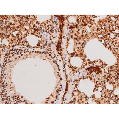 Polyclonal Rabbit anti-Human SYK Antibody (phospho-Tyr348, IHC, IF, WB)