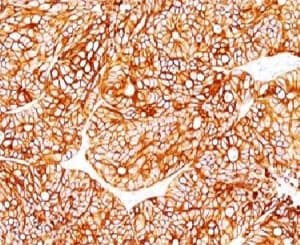 KRT18 / CK18 / Cytokeratin 18 Antibody (clone KRT18 Cocktail)