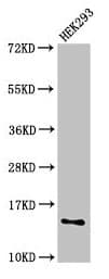 Polyclonal Rabbit anti-Human SNRPD1 / SMD1 Antibody