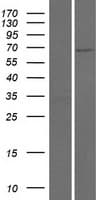 FPGT Protein (Over-Expression Lysate Myc-DDK (Flag))