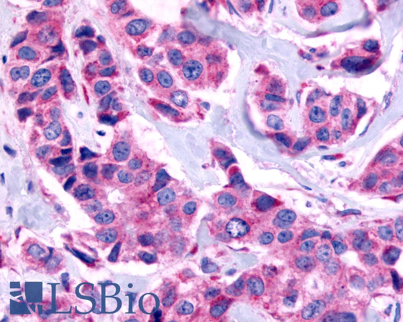 PathPlus™ Polyclonal Rabbit anti-Human ADGRF4 / GPR115 Antibody (C-Terminus, IHC)