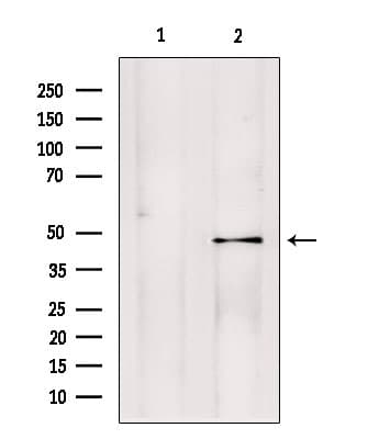 PMPCB / MPP11 Antibody