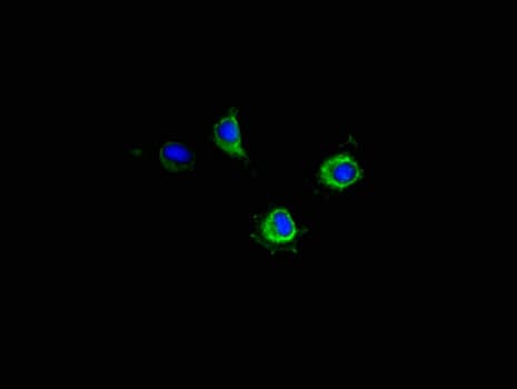 PIM2 / Pim-2 Antibody