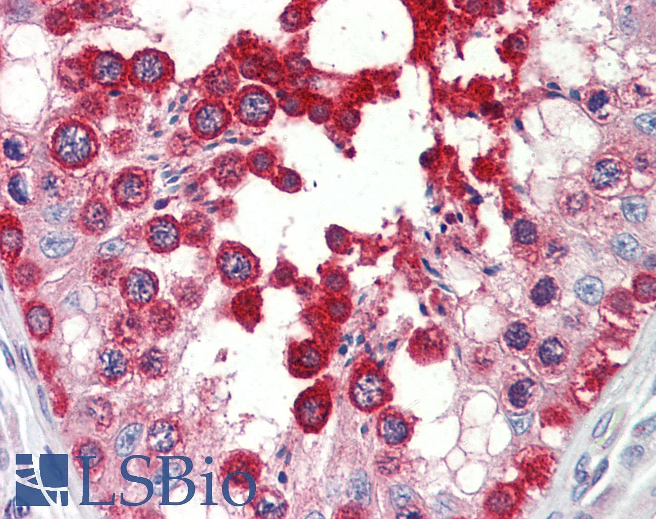 IHC-plus™ GPRC6A Antibody (aa489-517)