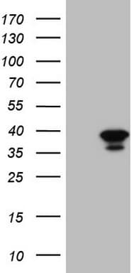 Monoclonal Mouse anti-Human GEMIN8 Antibody (clone OTI4E11, WB)