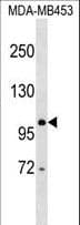 Polyclonal Rabbit anti-Human DDX24 Antibody (aa506-534, WB)