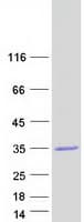 Human ABHD17B / FAM108B1 Protein (Recombinant Myc-DDK (Flag))