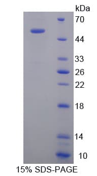 Human KIF18A Protein (Recombinant His, N-Terminal)