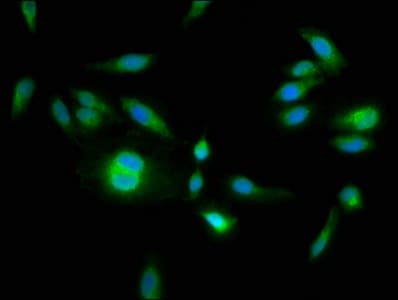 Polyclonal Rabbit anti-Human HPS6 Antibody (IHC, IF)