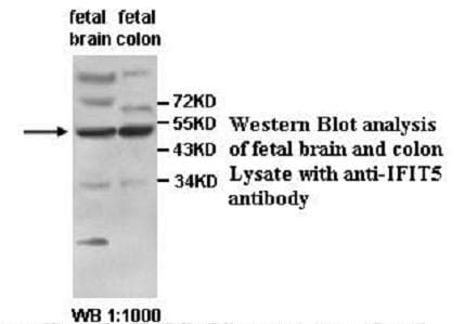 Polyclonal Rabbit anti-Human IFIT5 Antibody (aa79-294, IHC, WB)