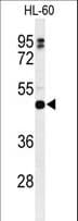 Polyclonal Rabbit anti-Human HLA-DRB5 Antibody (aa43-70, IHC, WB)