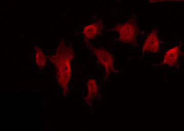 CDC42BPB / MRCKB Antibody