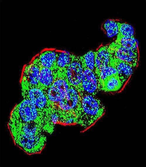 TS / Thymidylate Synthase Antibody (aa265-294)