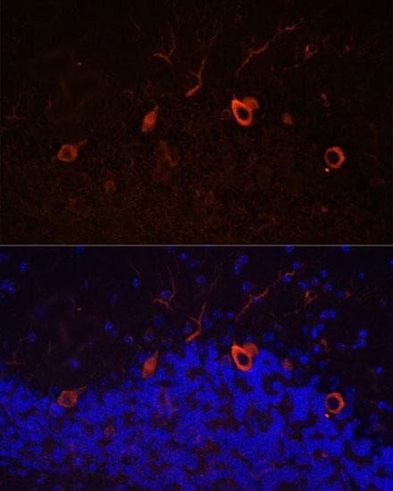 Polyclonal Rabbit anti-Human ANOS1 / Anosmin Antibody (IF)