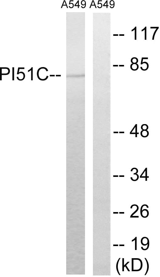 PIP5K1C Antibody (aa305-354)