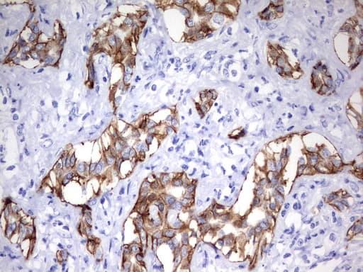 EPCAM Antibody (clone UMAB132)