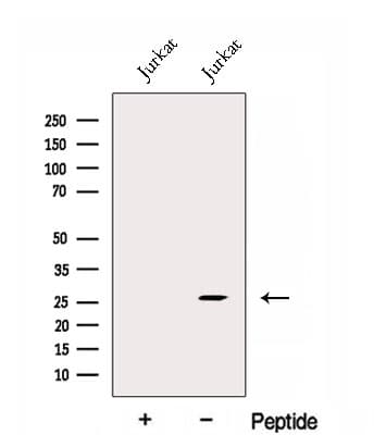 EXOSC4 / RRP41 Antibody