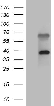 Monoclonal Mouse anti-Human ZFYVE1 / DFCP1 Antibody (clone OTI6C2, aa1-308, WB)