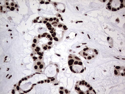 HNRNPL / hnRNP L Antibody (aa270-502, clone OTI9G7, Carrier-free)
