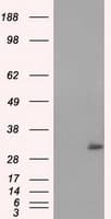 NIT2 Antibody (clone OTI3F3)