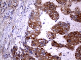 PIK3C2A Antibody (aa230-560, clone OTI4H9)
