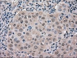 MAPK1 / ERK2 Antibody (clone OTI6E5)