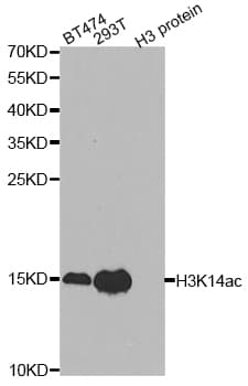 Polyclonal Rabbit anti-Human Histone H3 Antibody (Acetyl-Lys14, IHC, IF, WB)