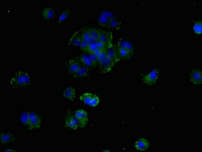 SMIM19 / C8orf40 Antibody