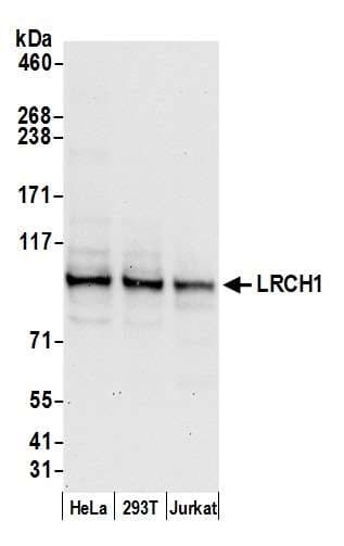 LRCH1 Antibody (aa375-425)