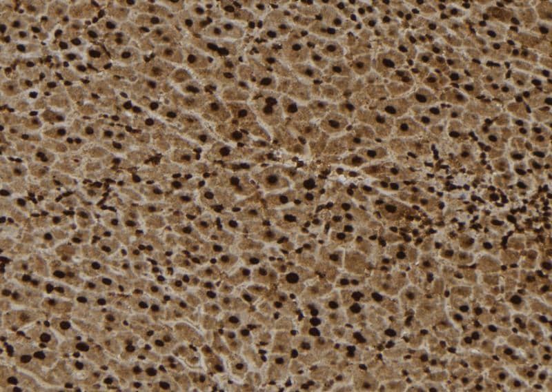 RPL4 / Ribosomal Protein L4 Antibody